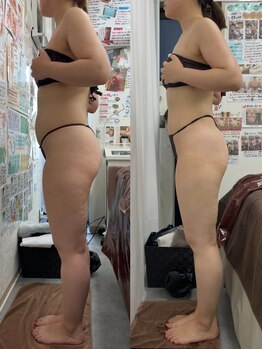 エスプレッソ(espresso,)/【1ヶ所10回】下腹マイナス5cm！