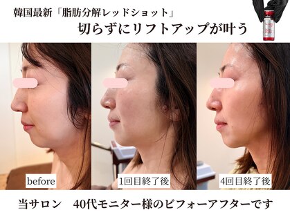 ビーズスタイル(B’S STYLE)の写真