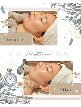 ハレル(Hareru)/Before…After(9)　UNSTRESS