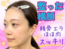 ナチュラルビューティーフェイス 横浜(NBF)