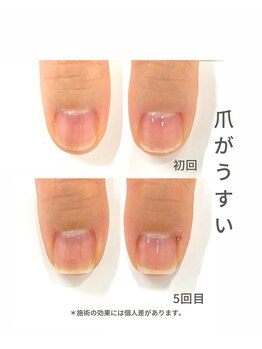 最強ネイルケア