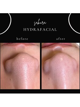 ビューティブロス(Beauty Bros)/