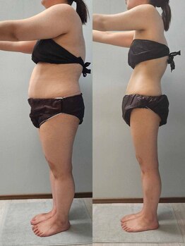 ルミルナ(Lumi Luna)/－20キロ達成★