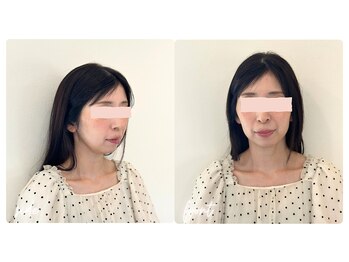 スタイルキューピット(style cupit)/メイクビフォアフター＊40代