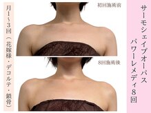 ラエッセ(La Esse)/ブライダル*美しいデコルテへ