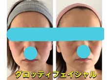 クラ接骨院(KURA接骨院)/シミケア