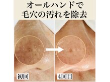 サロンルル(salon lulu)の雰囲気（毛穴汚れや黒ずみをすっきり除去。つるんとなめらかで明るい肌へ）