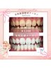 【女性大歓迎★】綺麗な白い歯に☆セルフホワイトニング40分¥6980→￥3000