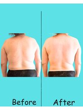 プララ(Plala)/全身リンパ１２０分