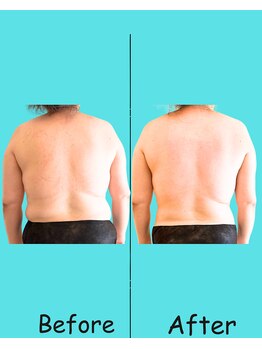 プララ(Plala)/全身リンパ120分