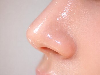 リアン 本町(Lien.)の写真/<本町/本物志向が集う印象管理室>もう悩まない!黒ずみ毛穴,たるみ毛穴,開き毛穴などALL毛穴タイプに対応◎