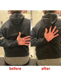 ナオル整体 福岡香椎院(NAORU整体)/40代男性施術事例【結滞動作】　