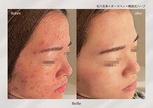 ベル 新橋(Belle)