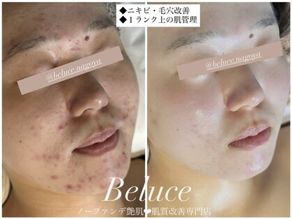 ベルーチェ(Beluce)の写真