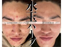 ヴェアリー 広尾(VARY)の雰囲気（水玉リフティングは10回1クールが推奨。2ヶ月集中でこの結果。）