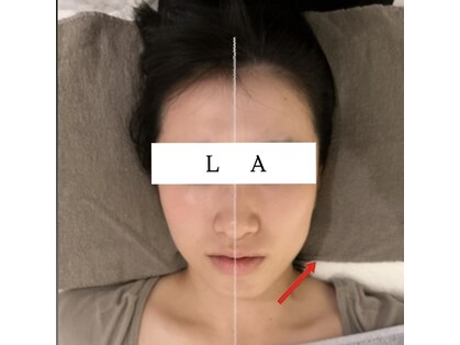 エルエー(LA)の写真