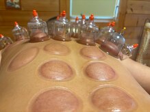 そーにゃの雰囲気（肩こり・首こり・背中の張り、筋肉の張りが気になる方におすすめ）