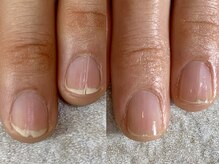 ネイルルーム エンヌ(nail room en'ne)/ネイルケアで自爪育成♪