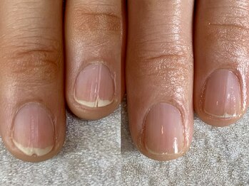 ネイルケアで自爪育成♪