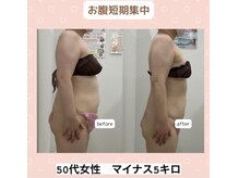 下っ腹ぽっこり＆腰浮輪肉撲滅【福島市痩身美容整体】