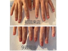 ネイルサロン ラグゼ(Nail salon Luxe)の雰囲気（初回★自爪育成深爪改善ワンカラー施術・保湿パック付　8000円　）