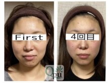 キュープ 名張店(Qpu)/通常コース4回での変化