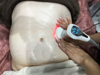 しん整骨院の写真/男性の為の特別ダイエットプログラム◎脂/糖/筋肉タイプ別の医療機関監修◎3ヵ月徹底管理ダイエット体験★