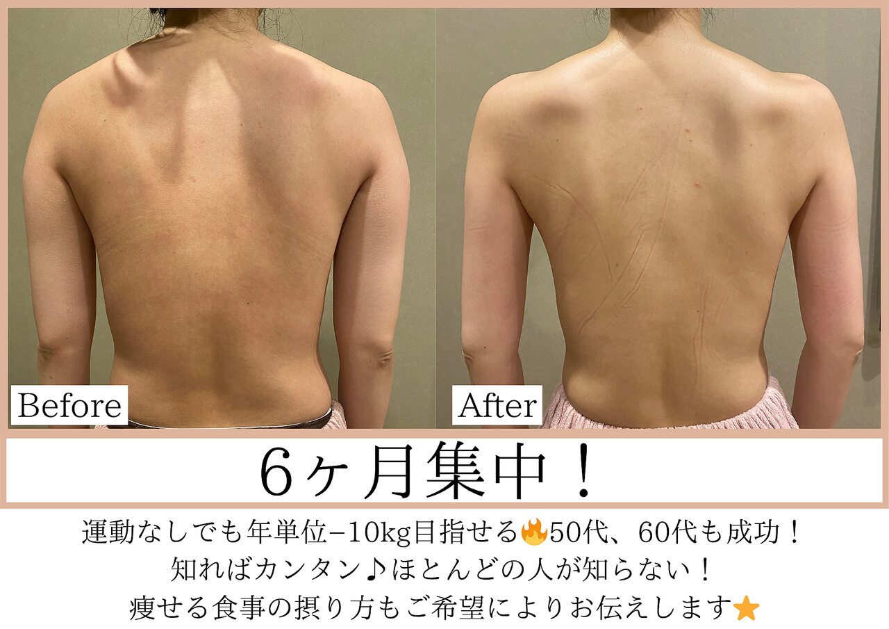 シェイプリフト　定価約30万　美容　痩身　ダイエット エス シークレット 金町店(S secret)｜ホットペッパービューティー