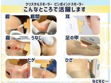 ベオ(Salon Beo)の雰囲気（ピンポイント脱毛が出来るサロン！他社で抜けなかった部分のOK）