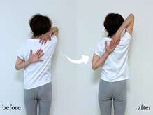 エーアール(AR)/【Before/After】4回目