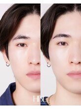 スタジオサンハチゴ(studio-385)/【眉毛】ハリウッドブロウリフト