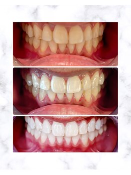 エスビーワイビューティー(SBY Beauty)/