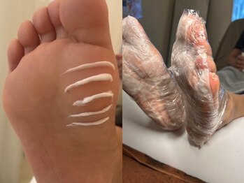 ベティ(Betty)/足裏角質ケアPEDiNET