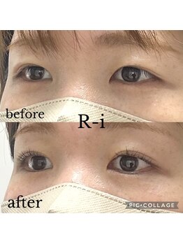 アールアイ(R-i)/アイリッドアップパーマ