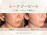  【毛穴ごわつき】最新シーナジーピールでつるん透明美肌へ 60分《初回向け》