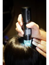 はじめにお客様の頭皮をスコープで今どんな状態かをチェックしていきます★