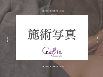 クレヴィア バイ サイバーエステ(CREBIA)/1人1人のお悩みに合わせてご提案