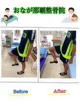 おなが浦添当山整骨院/股関節の可動域UP！