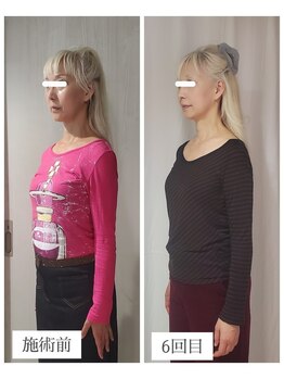 エクラ(eclat)/お客様の変化（横）