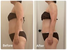 ナビ(NABI)/筋膜リリースで姿勢美人