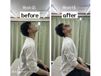 由利本荘整体院/施術ビフォーアフター（首）