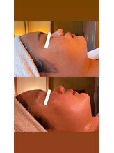 ワッカ(wacca)/【ヒト幹細胞】