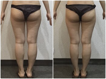 美容整体ウェリナ 名駅院/小顔矯正/骨盤矯正/美脚サロン