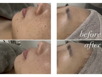 サロン ビュー(salon view)/ダクトピール/ビフォーアフター