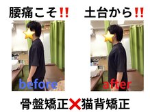 えびす整骨院 北浦和駅西口院/腰痛は身体の土台から調整！