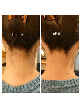 【光脱毛/WAX脱毛】doucek beauty/うなじワックス+光脱毛