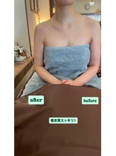 オンリ(ONRI)/巻き肩ビフォー&アフター