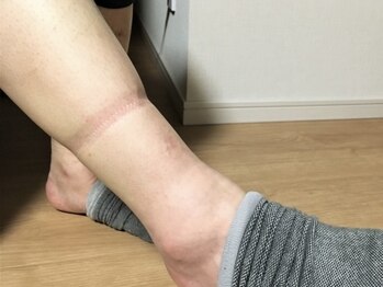 ココロ(COCORO)の写真/重だるい頑固なむくみ解消！リンパマッサージで美脚へ導きサポート☆