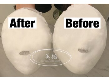 美極 銀座店/銀座/小顔コルギ/小顔矯正