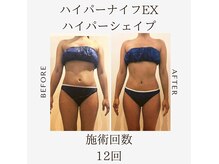 ラウレア(Laure'a)の雰囲気（人気No.1☆EXとシェイプで、引き締まった理想のボディに☆）
